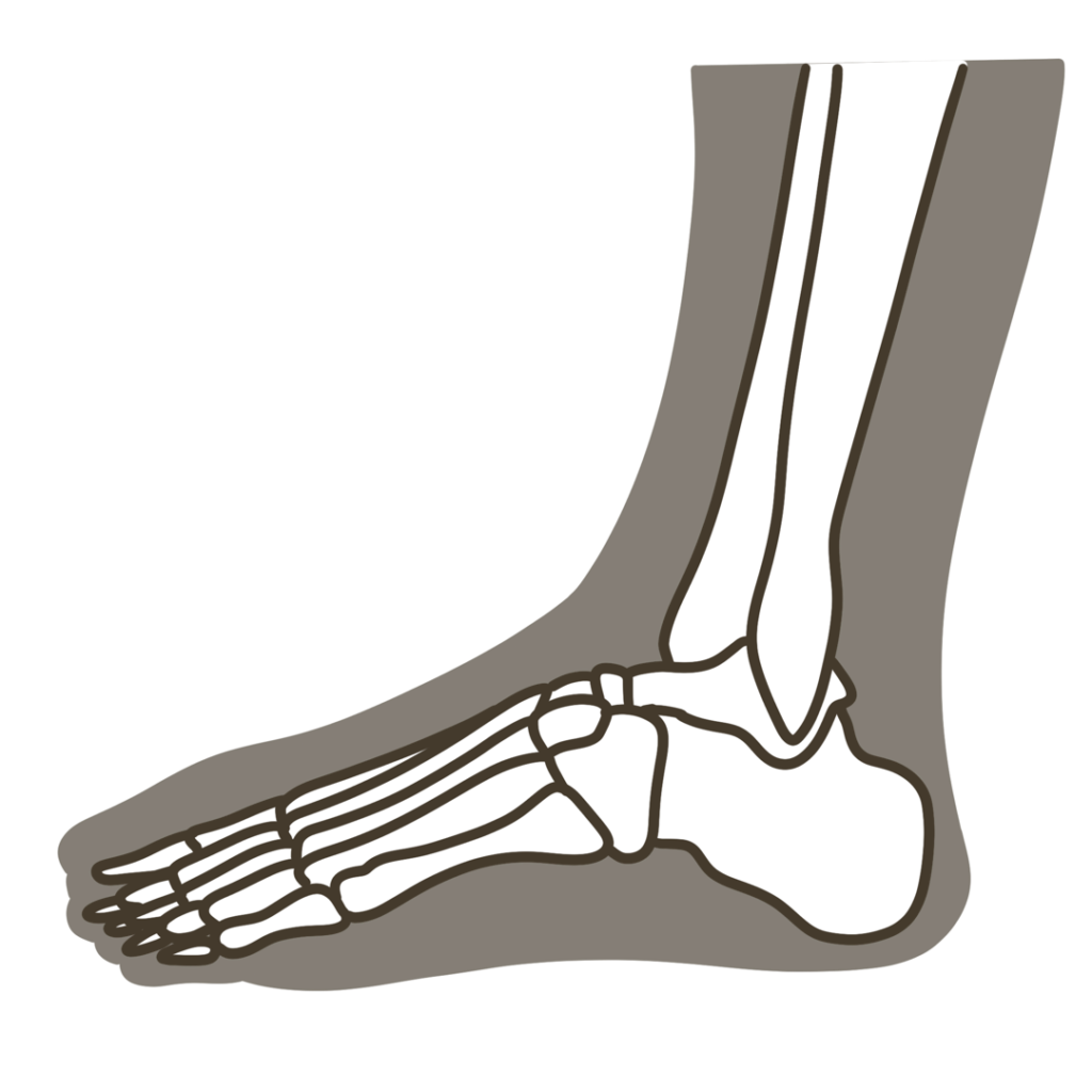 足 側面（小指側）骨格重ね図 左足のイラスト｜図解や資料作成に使える素材